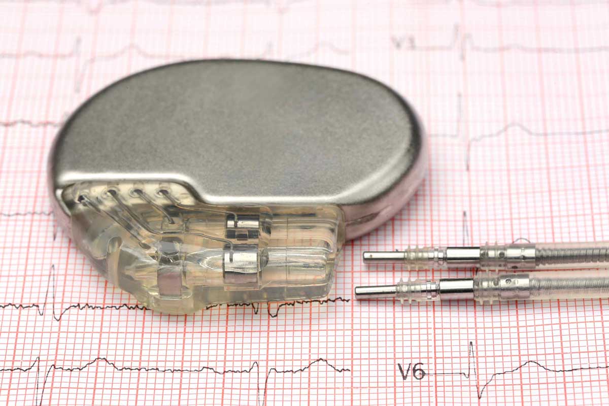 Kalp Pili Pacemaker Tedavisi