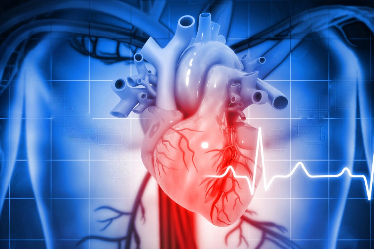 heart2500-1200x800-skoq0K